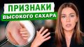 Признаки высокого уровня сахара у женщин: на что обратить внимание